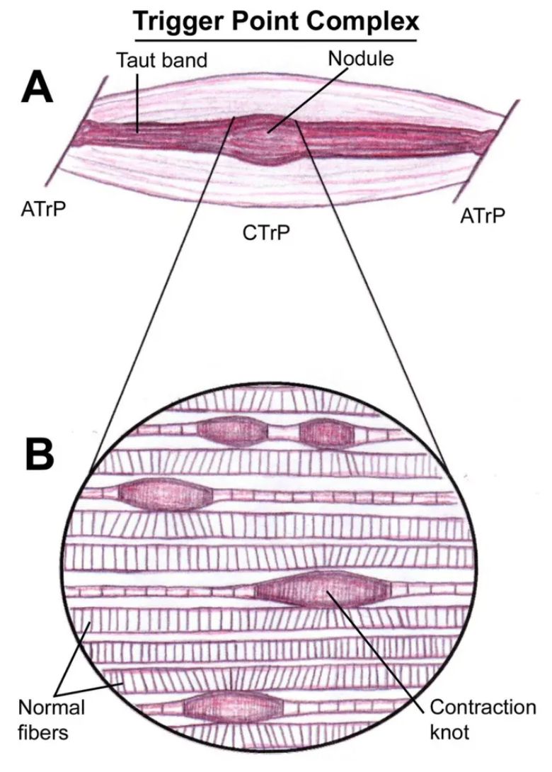 How To Use A Foam Roller Correctly To Exercise And Relax?cid=165